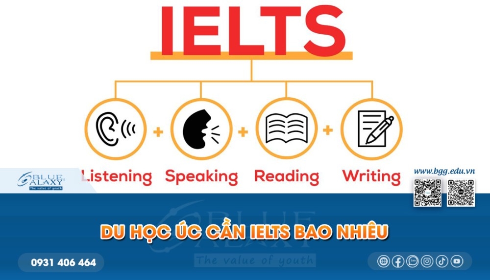 Du Hoc Uc Can Ielts Bao Nhieu